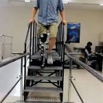 Jambe bionique en test [3]